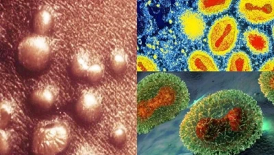 دول تسجل حالات إصابة جديدة بجدري القرود على أراضيها