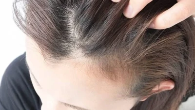 أسباب تساقط الشعر وطرق العناية به