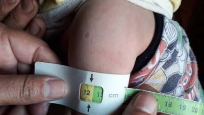 ارتفاع عدد حالات سوء التغذية بين الأطفال في سوريا