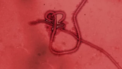 مخاوف من وصول "حمى النزفية" لسوريا