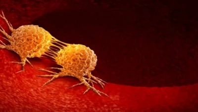 كراهـ.ـية بعض الأطعمة تشير إلى الإصـ.ـابة بالسـ.ـرطان