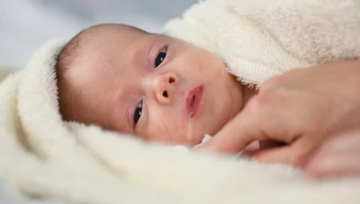 أعراض الارتجاع الصامت عند الرضع