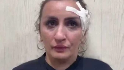 أم تبيع رضيعها بـ 3600 دولار لإجراء عملية تجميل لأنفها