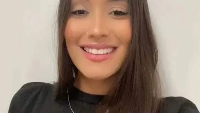 عملية تجميل تشـ.ـوه وجه فتاة بالكامل