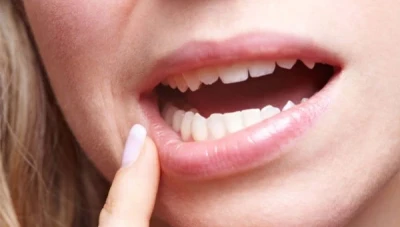 تفسير حلم سقوط الأسنان في المنام