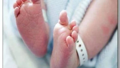 ولادة رضيع بأربع عيون وفمين اثنين في سوريا