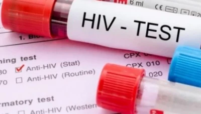 وزارة الصحة تصدر إحصائية جديدة حول المصابين بمرض الإيدز 