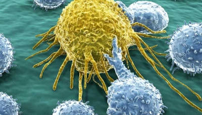 أخطاء غذائية شائعة تزيد من نسبة الإصابة بالسرطان