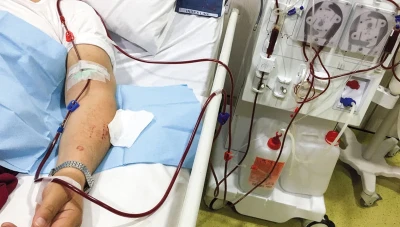 أجهزة غسيل الكلى خارج الخدمة