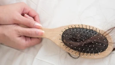 عـ.ـلاجات فعالة لتساقط الشعر