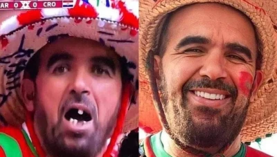 طبيب يتـ.ـبرع بصنع ابتسامة جميلة لشاب ظهر في لقطة عفوية أمام الكاميرا