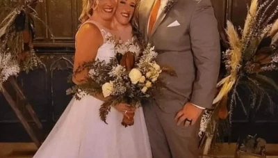 دراسة حالة التوأم الملتصق ومسائل الزواج والوراثة (صورة)