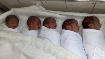 ولادة 5 توأم بأعجوبة