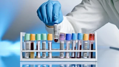 اسباب ارتفاع أسعار التحاليل الطبية في سوريا