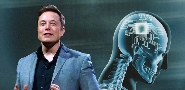 إيلون ماسك يعلن عن نجاح أول عملية زراعة لشريحة دماغية