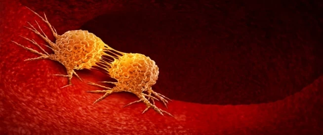 كراهـ.ـية بعض الأطعمة تشير إلى الإصـ.ـابة بالسـ.ـرطان