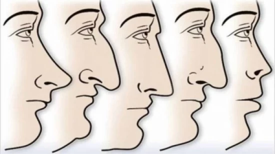 "اختبار غريب" اعرف شخصيتك من شكل أنفك