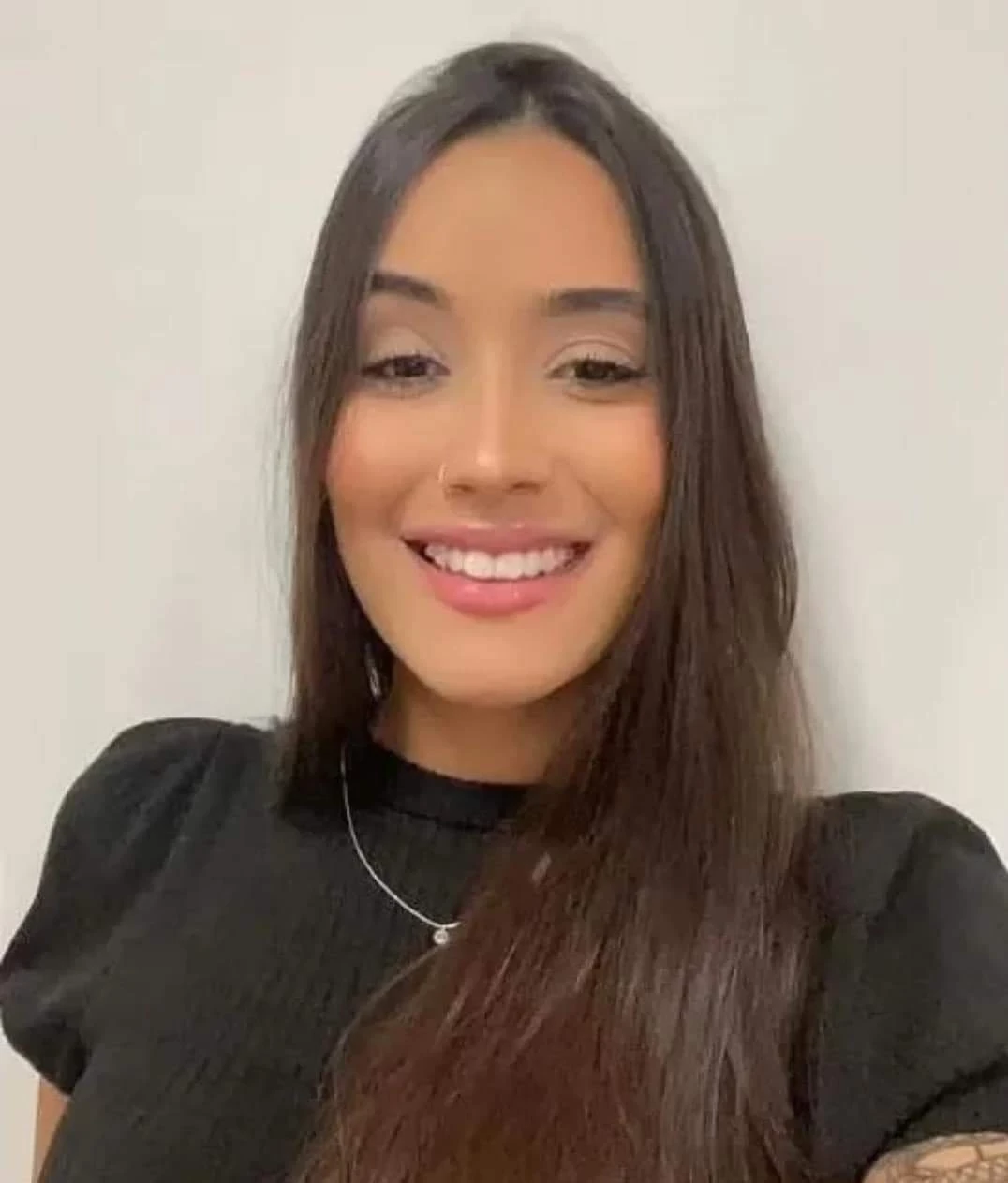 عملية تجميل تشـ.ـوه وجه فتاة بالكامل