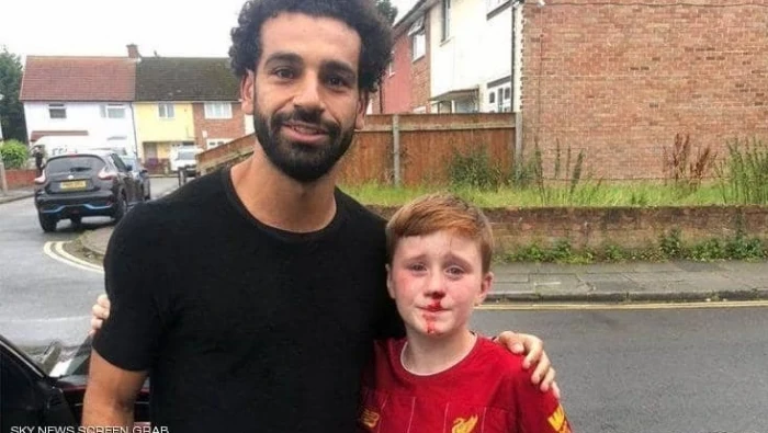 محمد صلاح ينقذ "الطفل النازف"