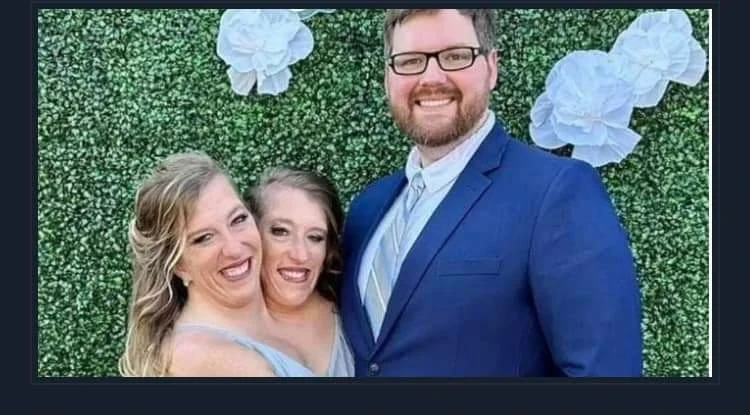 زواج أشهر توأم ملتصق في العالم: آبي وبريتاني هانسيل تتزوجان جنديًا أميركيًا