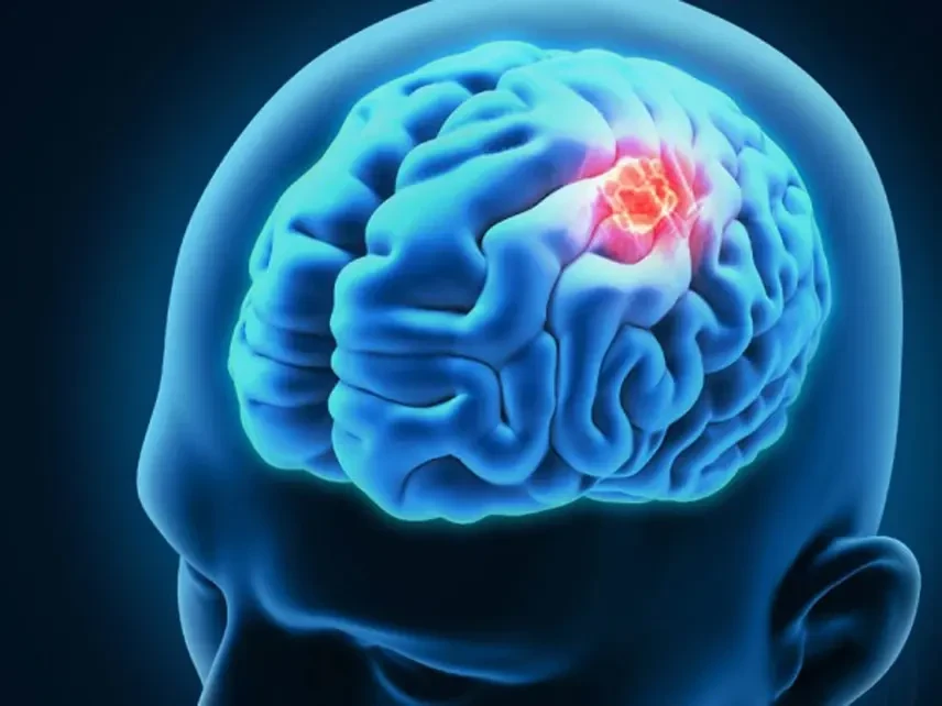 إنجاز طبي ملفت: طفل يتغلب على سرطان الورم الدبقي في الدماغ!
