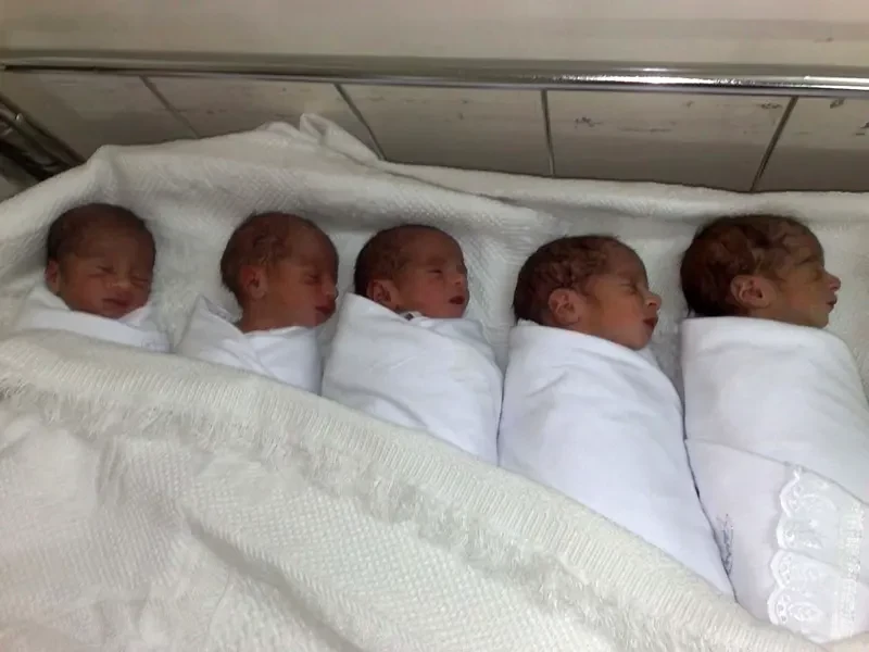 ولادة 5 توأم بأعجوبة
