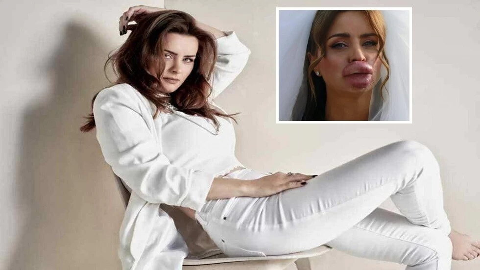 عملية تجميل خاطئة للفنانة نور في فيلم "الدكتور نبيل أخصائى التجميل"